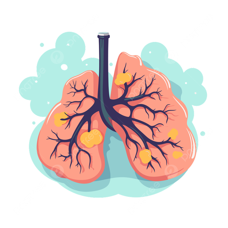 lung cancer diagnosis